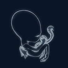Sigur Ros - Agaetis Byrjun (Vinyl 2LP)